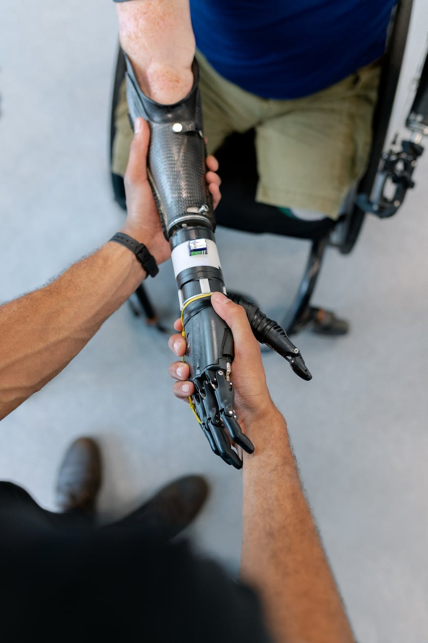 person holding prosthetic arm